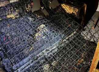 Hombre se duerme con cigarrillo encendido y sufre graves quemaduras hombre-se-duerme-con-cigarrillo-encendido-y-sufre-graves-quemaduras