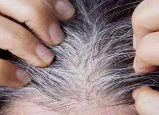 Cómo eliminar las canas de forma definitiva: Descubre el secreto científico cmo-eliminar-las-canas-de-forma-definitiva-descubre-el-secreto-cientfico