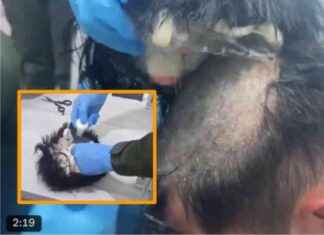 Hombre en Colombia es detenido en aeropuerto de Cartagena por esconder droga en peluquín (VIDEO) hombre-en-colombia-es-detenido-en-aeropuerto-de-cartagena-por-esconder-droga-en-peluqun-vdeo