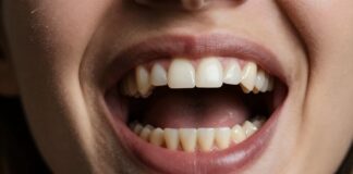 Descubre el significado de soñar que se te caen los dientes